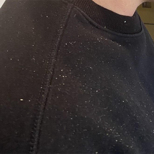 Serum protiv peruti - pre tretmana.png__PID:56e84af3-9b3a-434d-8930-ef8f4bd26f49